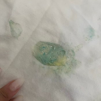 Peros Kapsül Deterjanı Kot Pantolonu Mahvetti: Ürün Hatası Ve Tazminat Talebi