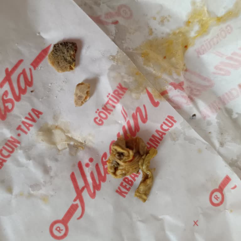 Çorbanın İçinde Deri Ve Kemik Bulundu, Müşteri Temsilcisi Saygısız Davrandı