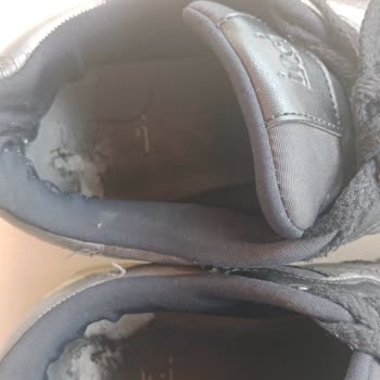 Adidas Ve İnci Ayakkabılarındaki Kalite Sorunları Ve İnceleme Reddine İade İsteği