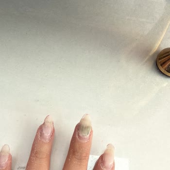 Hijyen Eksikliği Nedeniyle Protez Tırnakta Sağlık Problemi