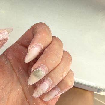 Hijyen Eksikliği Nedeniyle Protez Tırnakta Sağlık Problemi