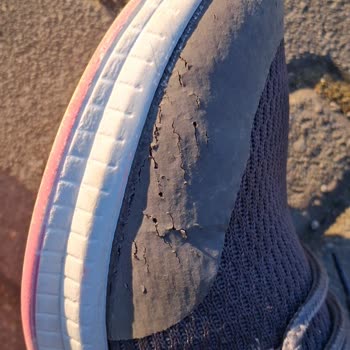 Hayal Kırıklığı Yaratan Çatlayan Slazenger Ayakkabılar İade Talebi