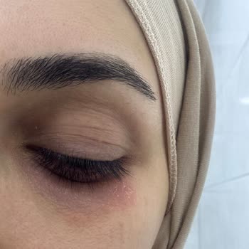 Bioderma Atoderm Intensive Eye Kremi Göz Çevresinde Tahrişe Neden Oldu Ve İade İstiyorum