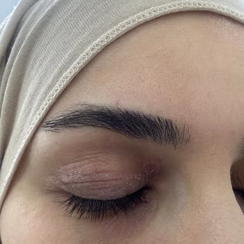 Bioderma Atoderm Intensive Eye Kremi Göz Çevresinde Tahrişe Neden Oldu Ve İade İstiyorum