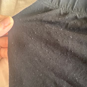 Aynı Üründe Çekme Sorunu Olmasına Rağmen İade Reddedildi Ve Ayrımcılık Yapıldı