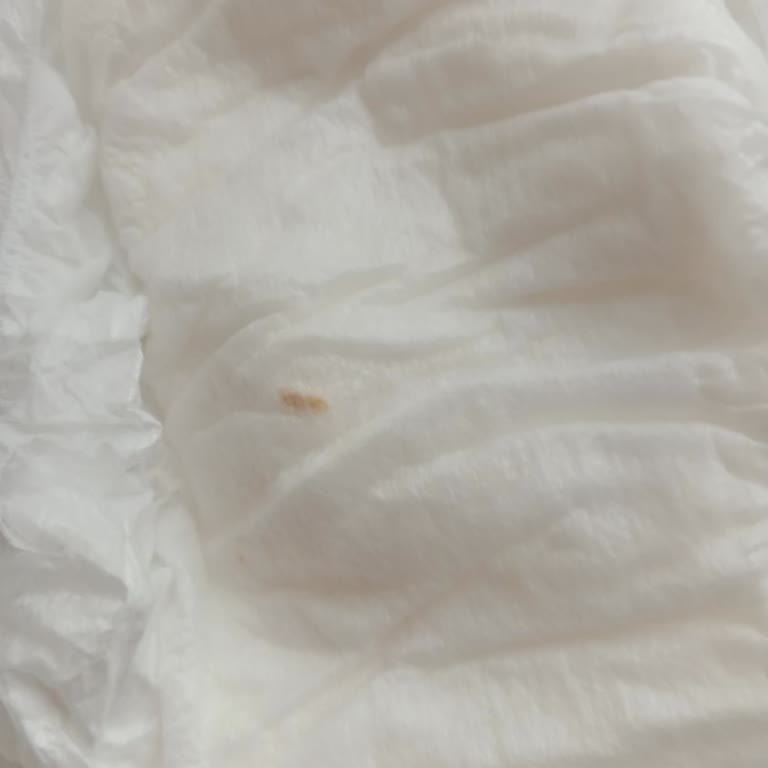 Sleepy Bebek Bezinde Sert Cisim: Çocuk Güvenliği Ve Hijyen Endişesi