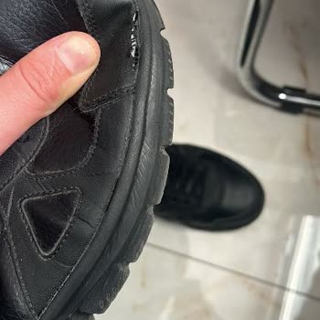 Skechers Ayakkabısında Üretim Hatası Ve Garanti Reddi