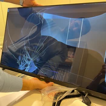Kırık TV Ekranı Ve A101’in Cevapsız Müşteri Hizmeti