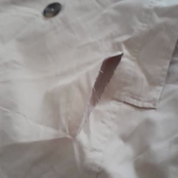 Kusurlu Trençkot Ve Bonus Kaybı Şikayeti