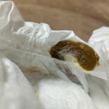 Molfix Bebek Bezlerinde Kullanılmış Görünüm Ve Hijyen Endişesi