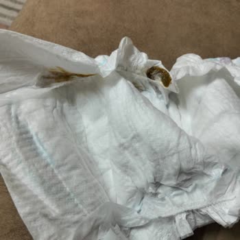 Molfix Bebek Bezlerinde Kullanılmış Görünüm Ve Hijyen Endişesi