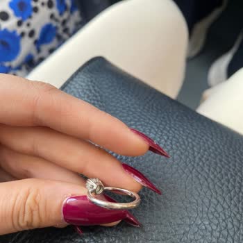 Alerjik Reaksiyon Yapan Yüzük İçin Ücretsiz Değişim Talebi