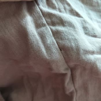 Kusurlu Tuniğin Ve İade Sonrası Worldpuan Kesintisi Nedeniyle Mağduriyet