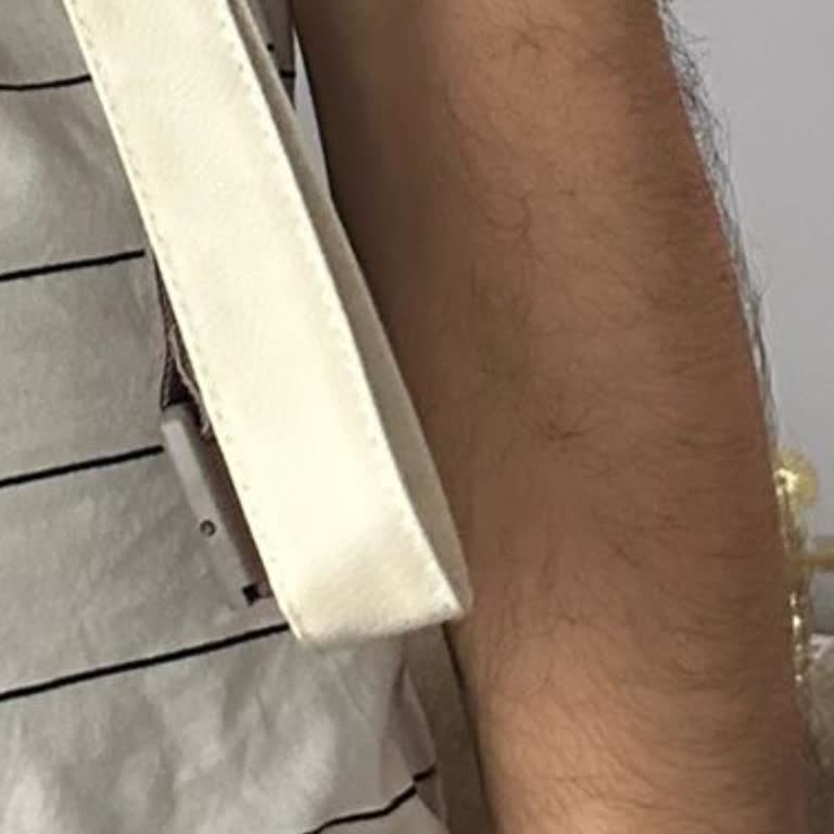 Esteworld Bahçelievler'de Dövme Silme Ve Lazer Epilasyon Sonuçlarından Memnuniyetsizlik