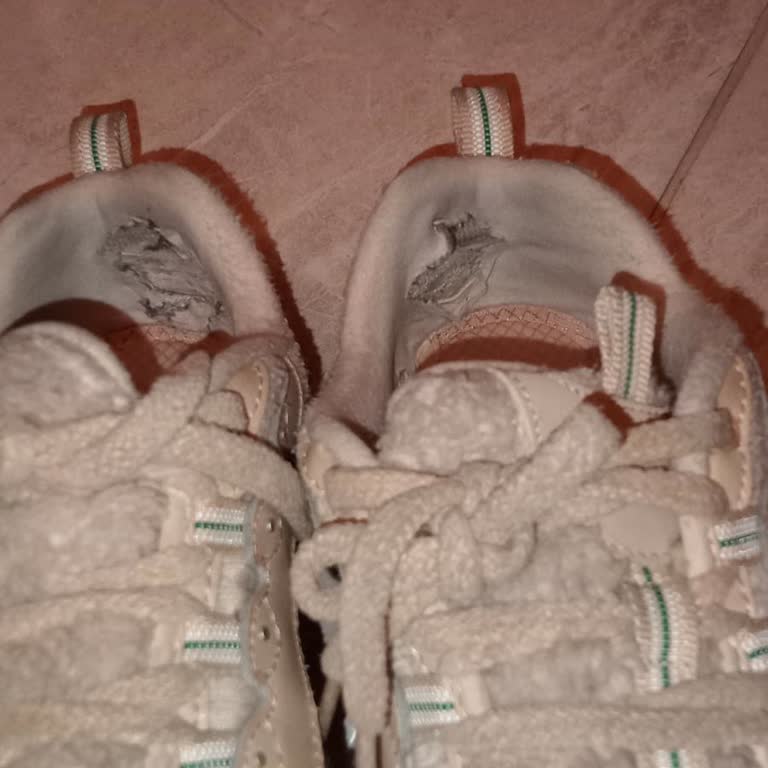 Skechers Ayakkabısının Erken Yırtılması Ve Kullanıcı Hatası İddiasına Yanıt