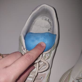 Garanti Süresi İçinde Deforme Ayakkabı Ve Değişim Reddine Şikayet