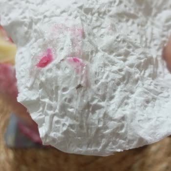 Böcekli Pasta Ve Yetersiz Yanıt Üzerine Tam İade Talebi