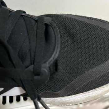 Adidas Ayakkabısının Kısa Sürede Patlaması Ve Mağazanın Çözüm Sunmaması