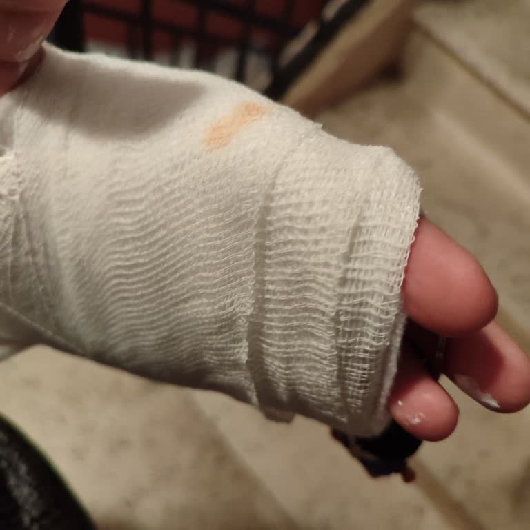 Tekrar Eden Fren Kilitlenmesi Nedeniyle Kaza Ve Sağlık Masrafları İçin Tam İade Talebi