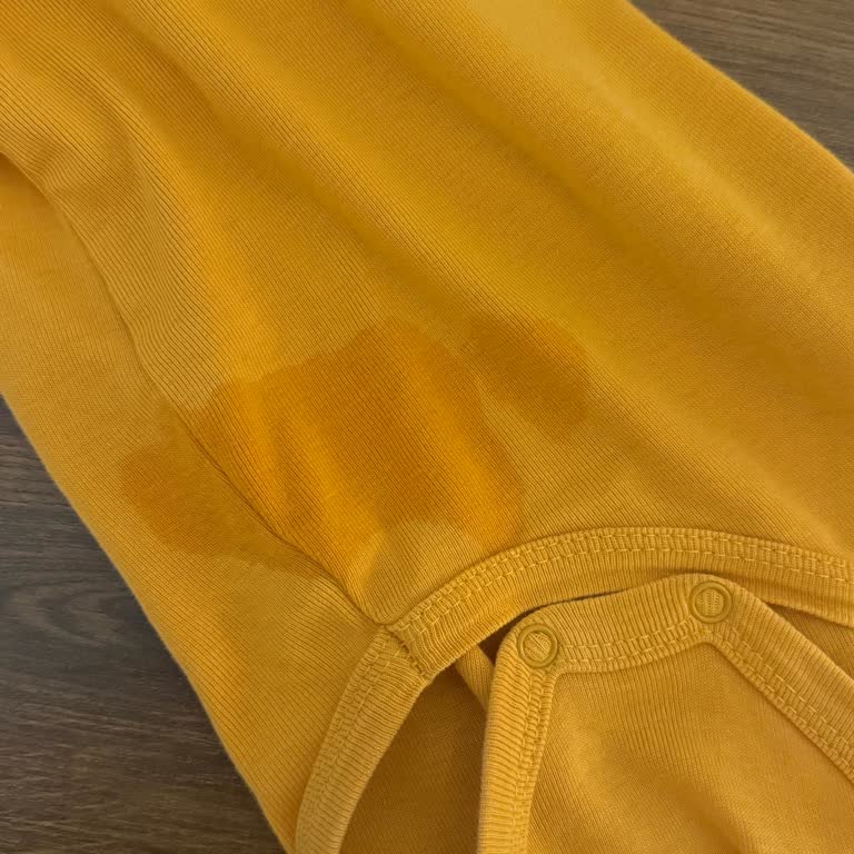 Smart Fit Bezinde Sürekli Sızma Ve İade Talebi