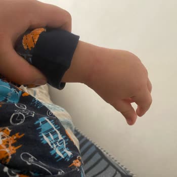 Şamlar Piknik Ormanı’nda Tırtıllar Nedeniyle Alerjik Reaksiyon Ve Uyarı Eksikliği
