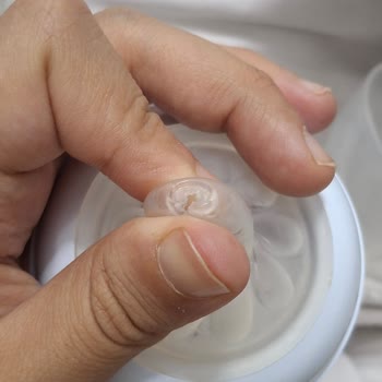 Philips Avent Biberon Başlığı 20 Günde Yırtıldı