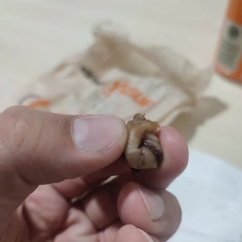 Köfteci Yusuf Kavurmalı Tosta Hijyen İhlali Ve Sağlık Riski