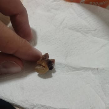 Köfteci Yusuf Kavurmalı Tosta Hijyen İhlali Ve Sağlık Riski