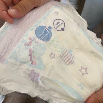 Molfix 5 Numara Bebek Bezlerinde Kesik Kenar Ve Sızdırma Sorunu Değişim Talebi