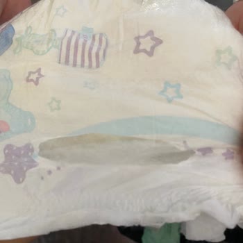 Molfix 5 Numara Bebek Bezlerinde Kesik Kenar Ve Sızdırma Sorunu Değişim Talebi