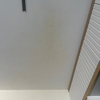 Patlayan Düdüklü Tencere Ve Ciddi Yanıklar