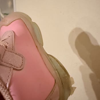 Vicco Çocuk Botunda Kısa Sürede Patlama Ve Müşteri Hizmetlerinin Desteksizliği