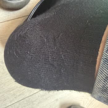 Satın Alınan Çoraplarda İlk Kullanımda Şiddetli Tüylenme Ve Kalite Sorunu