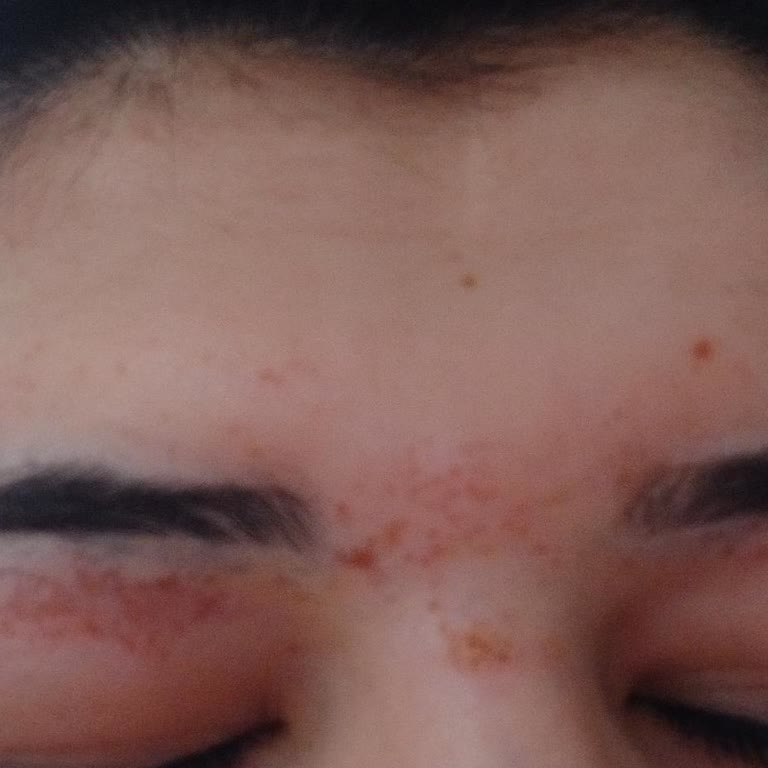 Şok Marketler Ten Markalı Tüy Dökücü Krem Şikayeti