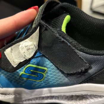 Skechers Ayakkabım 1 Ayda Parçalandı, İade Reddi Beni Hayal Kırıklığına Soktu