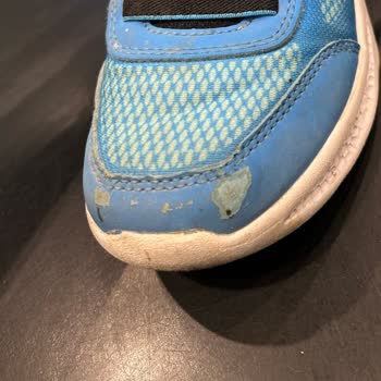 Skechers Ayakkabım 1 Ayda Parçalandı, İade Reddi Beni Hayal Kırıklığına Soktu