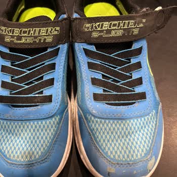 Skechers Ayakkabım 1 Ayda Parçalandı, İade Reddi Beni Hayal Kırıklığına Soktu