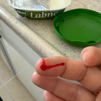 Keskin Ambalaj Kenarı Kullanıcıyı Yaraladı