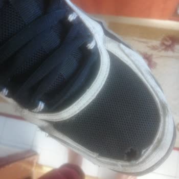 Skechers Ayakkabısının İç Astarı Hızla Yırtıldı Ve Kullanıcı Hatası İddiaları Haksız İade İstiyorum