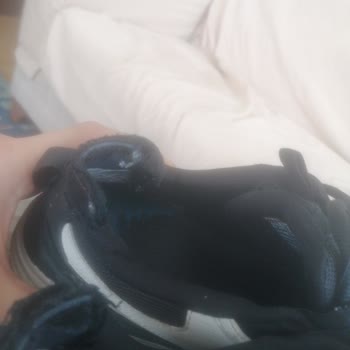 Skechers Ayakkabısının İç Astarı Hızla Yırtıldı Ve Kullanıcı Hatası İddiaları Haksız İade İstiyorum