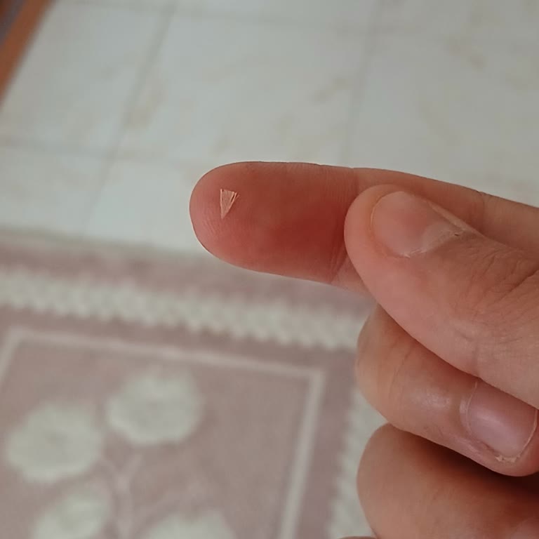Pınar Hindi Salamda Kanat Tüyü Ve Hijyen İhlali