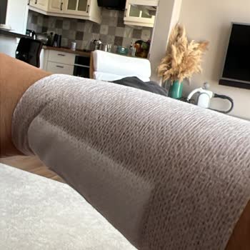 Solo Asılabilir Kağıt Havlu Aparatının Düz Metal Parçası Koluma Saplandı Ve Ciddi Yaralanma Yarattı