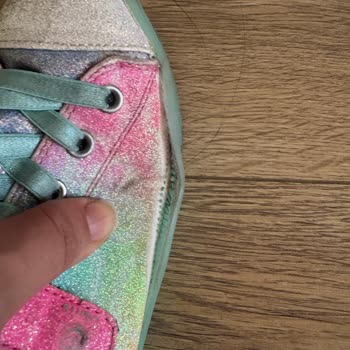 Skechers Çocuk Ayakkabısında 18 Gün İçinde Deformasyon Ve Satıcı Yanıtsızlığı
