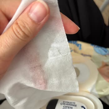 Molfix Izotonik Sulu Yenidoğan Islak Mendilde Kıl Görülmesi Ve Hijyen Endişesi