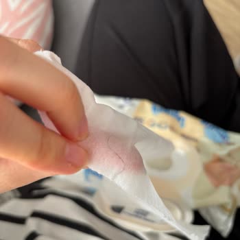 Molfix Izotonik Sulu Yenidoğan Islak Mendilde Kıl Görülmesi Ve Hijyen Endişesi