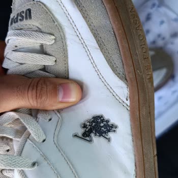 Garanti Kapsamındaki Spor Ayakkabılarda Erken Soyulma Ve İade Reddi