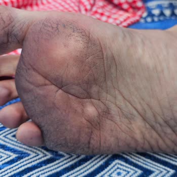 Ortopedik Terlikte Renk Akması Ve Mağaza Çözüm Sunmaması