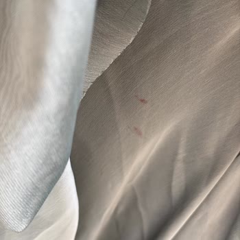Kiralanan Düğün Elbisesi Yırtık Ve Lekeli, İade Talebine Cevap Gelmiyor