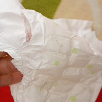 Sleepy Bebek Bezi 5 Numarada Artan Sızdırma Ve Yırtılma Sorunu