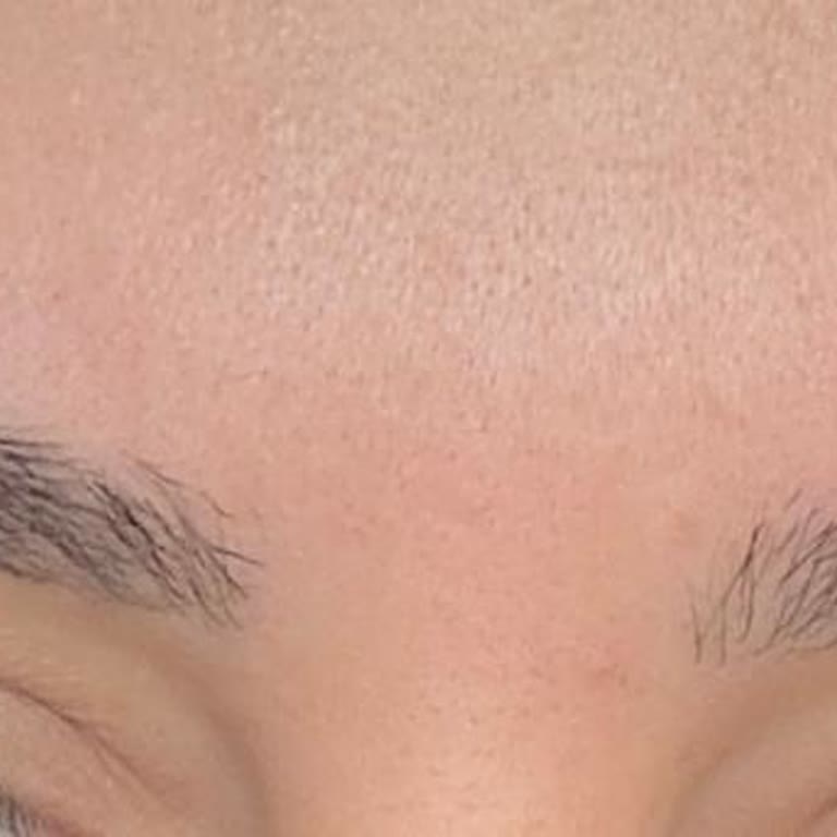 Pınar Karahan Beauty İki Kaşım Da Belirgin Şekilde İnceltilerek Orantısız Bir Hale Getirildi